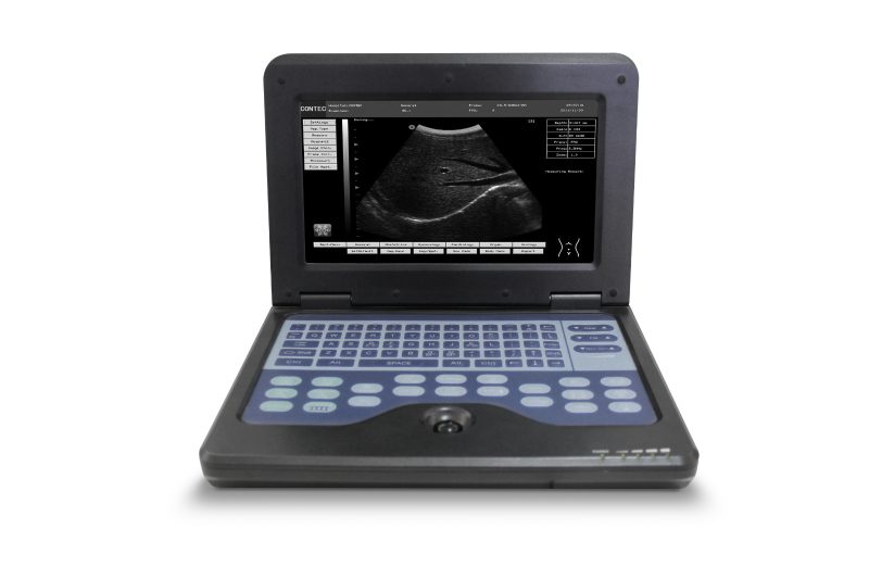 10.1" Laptop Ultrasound Scanner Digital Micro Convex Probe Cardiac Machine USA