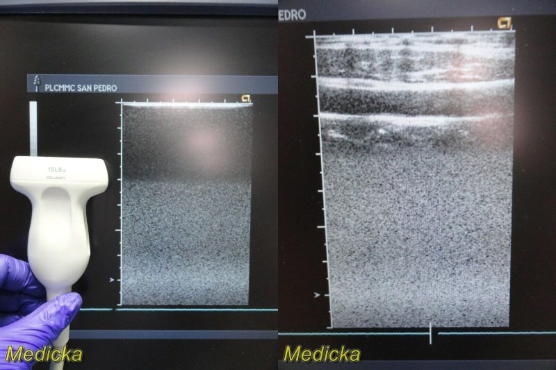 Acuson 15L8w Model 08241113 Ergo Linear Array Ultrasound Transducer Probe~ 22575