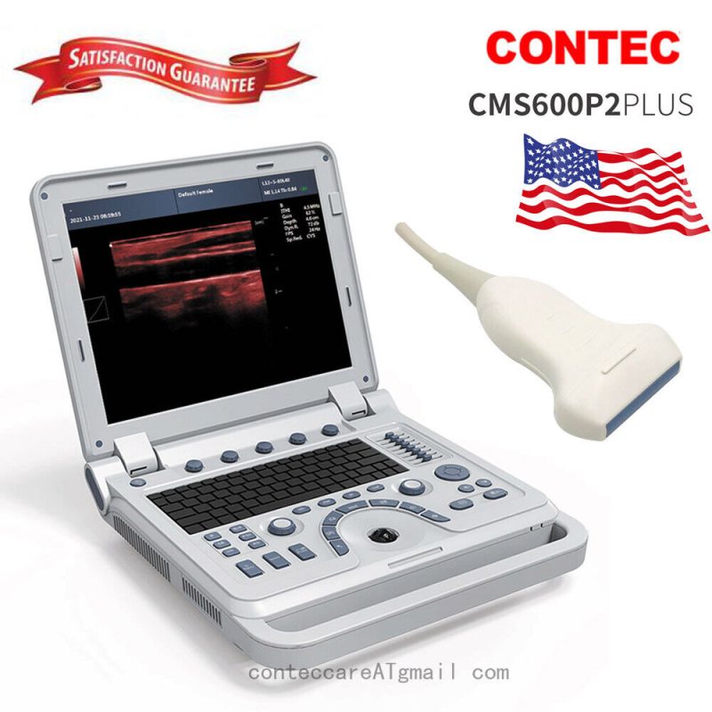 FDA Pseudo Doppler Ultrasound Machine Ultrasonic Diagnostic Scanner 7.5M linear