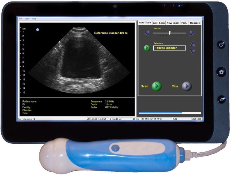 Interson Medical ViewBladder 10 Urology Bladder Scanner with Ultrasound Probe