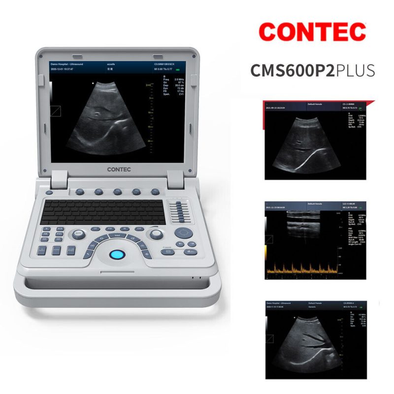 Laptop portable animal ultrasound Vet Pseudo-color doppler Ultrasound 3.5 convex