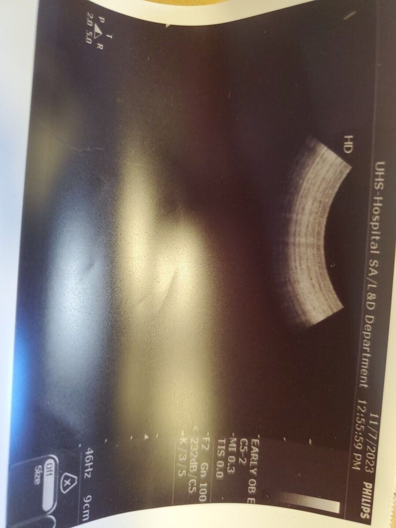 Philips C5-2 Convex Array Ultrasound Transducer/Probe