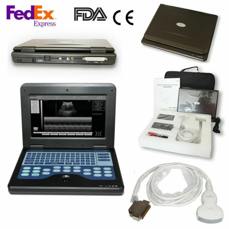 Portable laptop machine Digital Ultrasound scanner, 3.5 Convex probe,USA FedEx