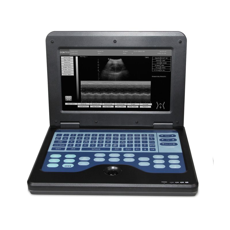 Portable laptop machine Digital Ultrasound scanner, 3.5 Convex probe,USA FedEx