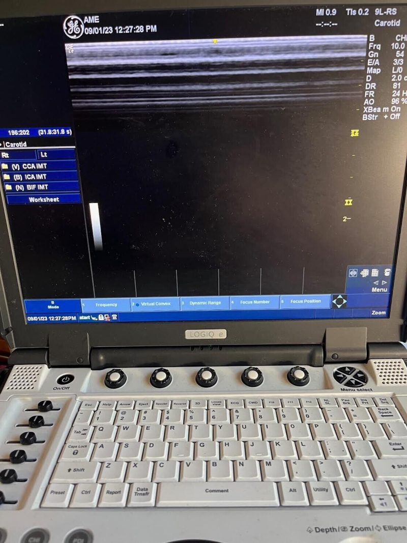 Refurbished GE 9L-RS Linear Array Ultrasound Probe Transducer (SN: 294333YP0)