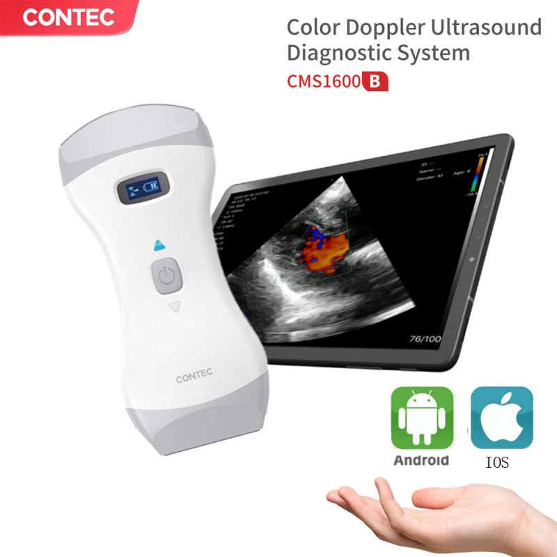 Vet Handheld Color Doppler Ultrasound for Cow and Horse,Wireless,3 in1 Mini,FDA