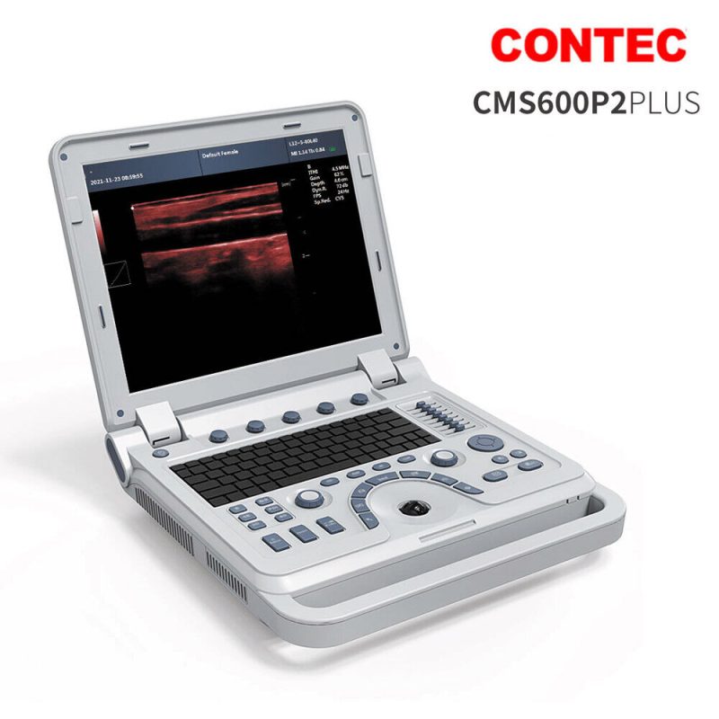 VET portable ultrasound machine pseudo color doppler,rectal,convex,Veterinary