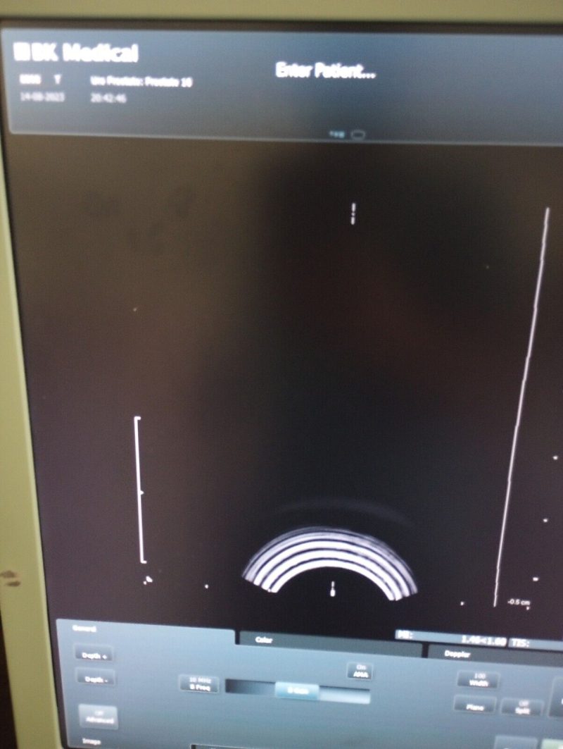 BK B&K Medical 8808 Ultrasound Transducer / Probe