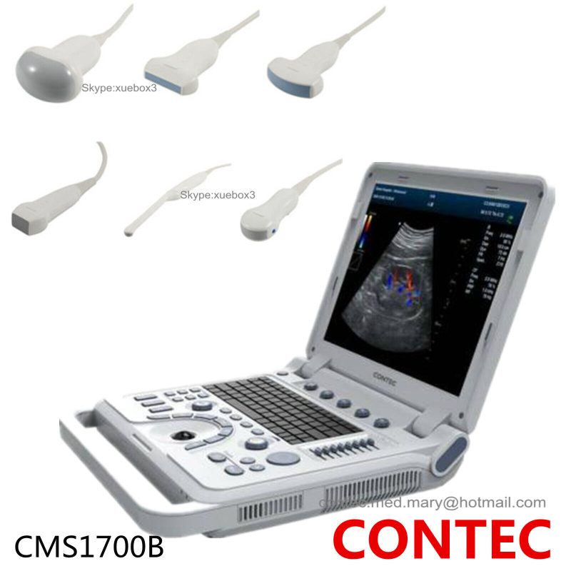 Color Doppler Diagnostic System Machine portable ultrasound Optional Probe 1700B