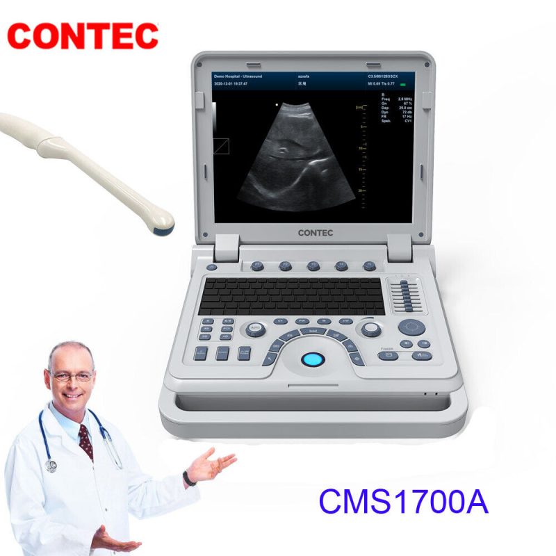 Color Doppler pregnancy obstetric scanner ultrasound machine transvaginal probe