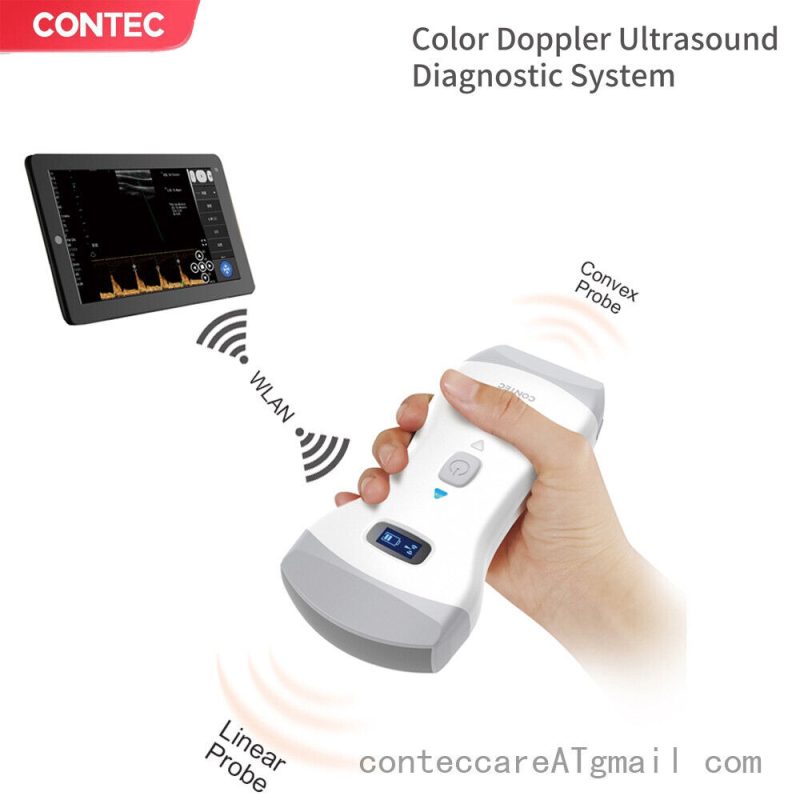 Color Doppler Wifi Double Mode Wireless Ultrasound Convex Linear Probe,Warranty