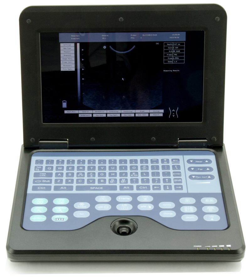 CONTEC CMS600P2 Laptop Ultrasound Scanner Machine Convex +Transvaginal