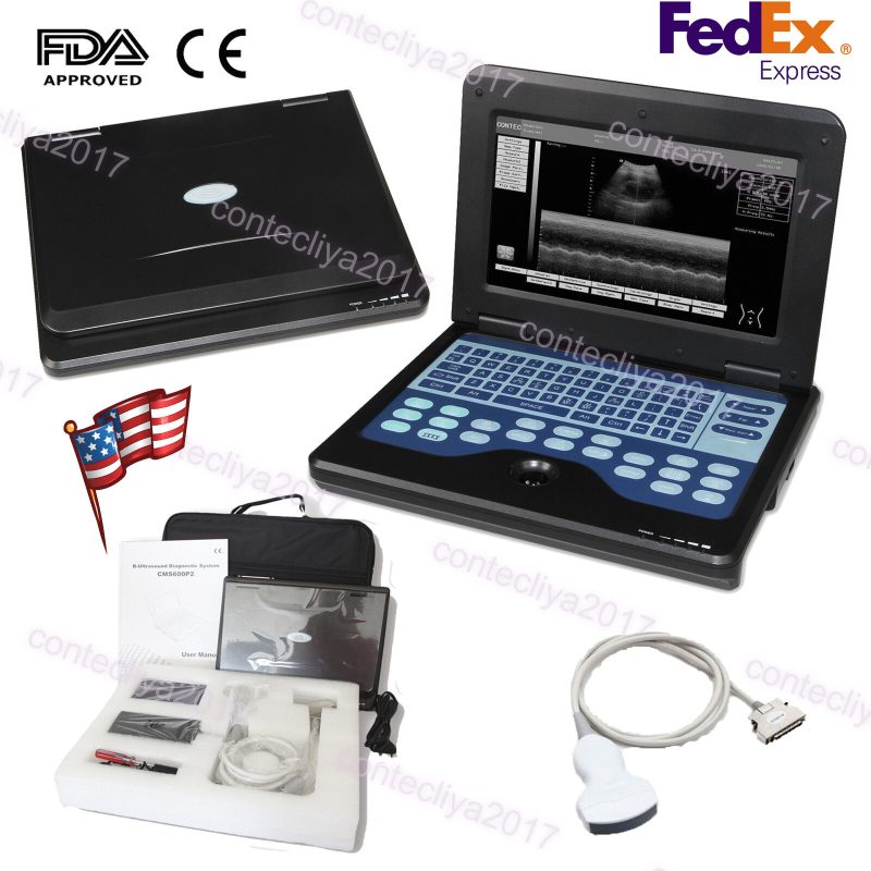 CONTEC Portable Laptop Digital Ultrasound Scanner Machine Convex Probe,CMS600P2