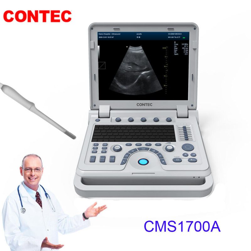 FDA Portable full digital color doppler B ultrasound scanner machine transrectal