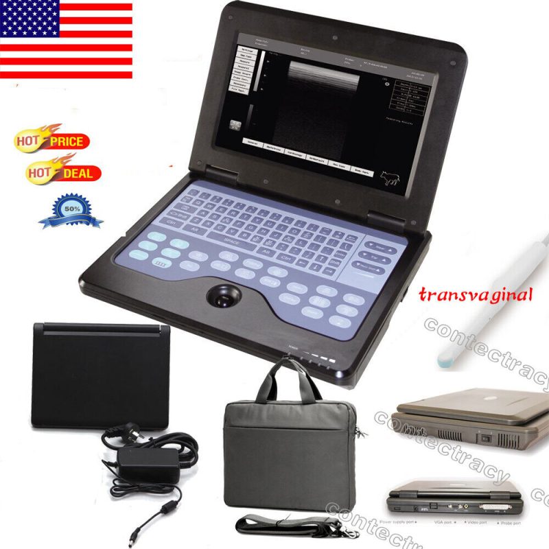 FDA Portable Laptop Machine Ultrasound Scanner With 6.5Mhz Transvaginal probe