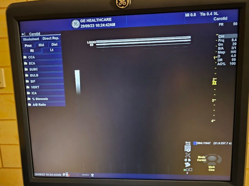 GE LOGIQ E9 LCD MONITOR - REMOVED FROM FULLY FUNCTIONAL 2014 MACHINE