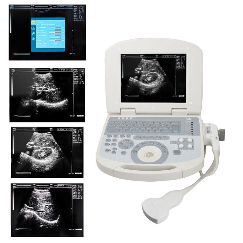 Medical Machine Laptop Machine Digital Ultrasound Scanner+3.5 Micro Convex Probe