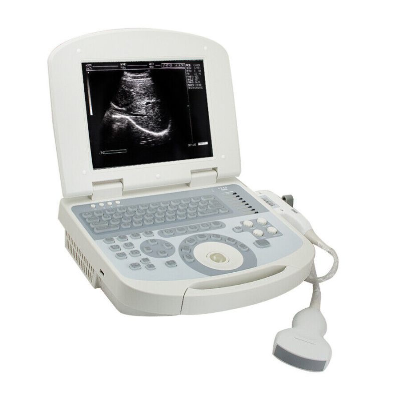 Medical Machine Laptop Machine Digital Ultrasound Scanner+3.5 Micro Convex Probe