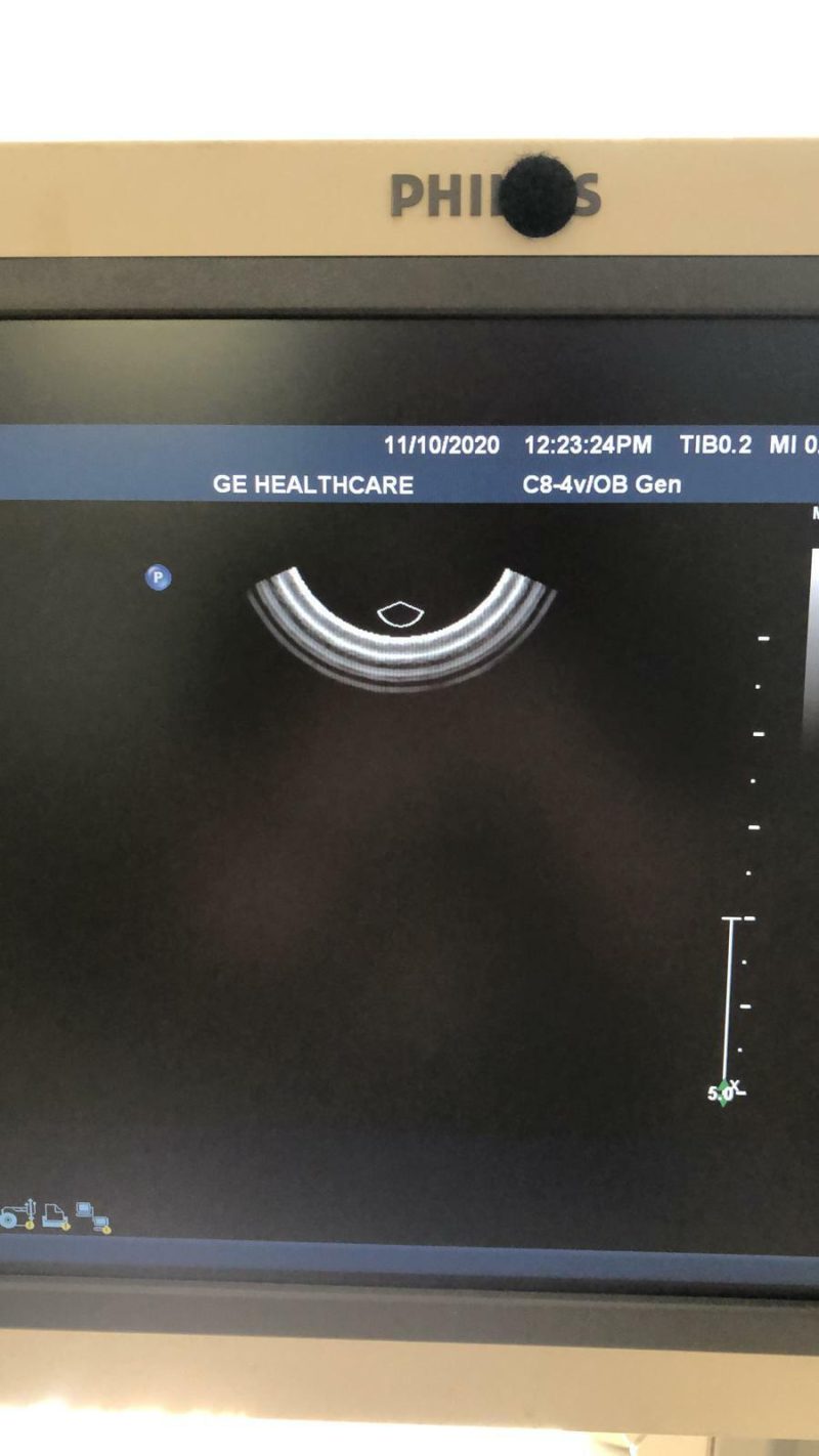 Philips C8-4V Ultrasound Probe Transducer