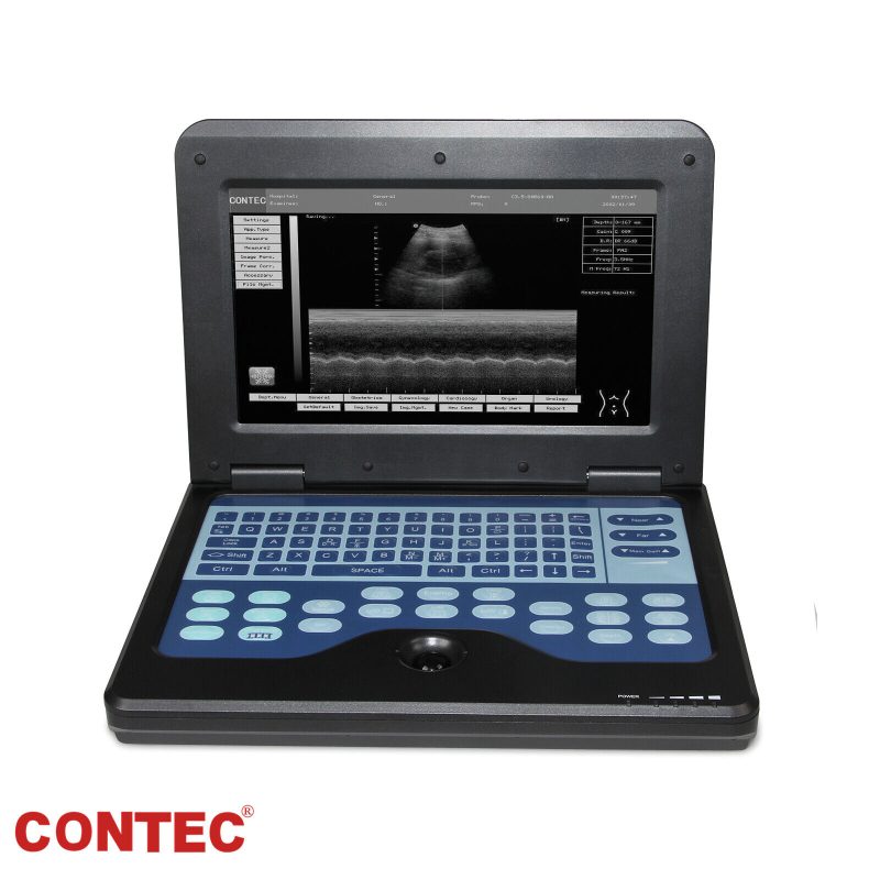 Portable Laptop Machine,Digital Ultrasound Scanner,7.5 Linear probe,cms600p2 FDA