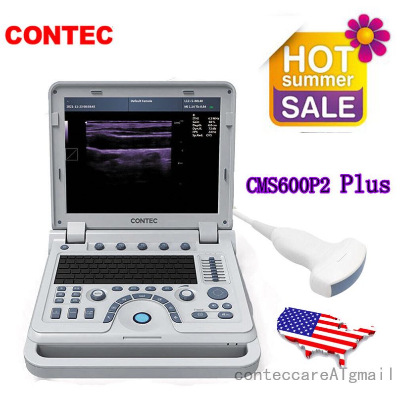 Portable Ultrasound Scanner Laptop Machine 3.5 Convex probe,pseudo-Color Doppler