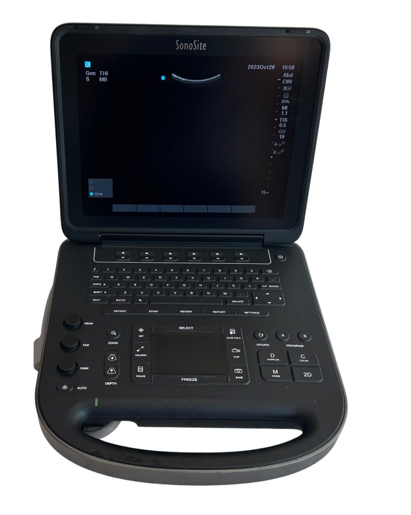 Sonosite Edge II Ultrasound 2017/Color Package DICOM, with rP19x Cardiac Probe