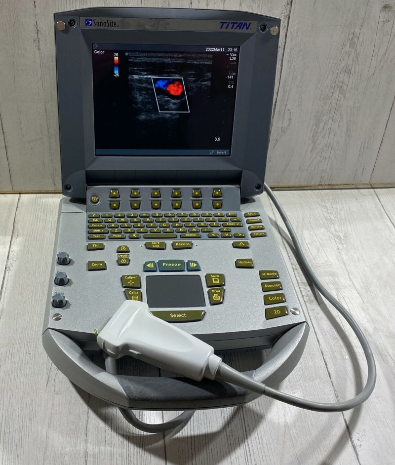 Sonosite Titan  Portable Ultrasound 2005 - With Linear Array probe L25 Probe