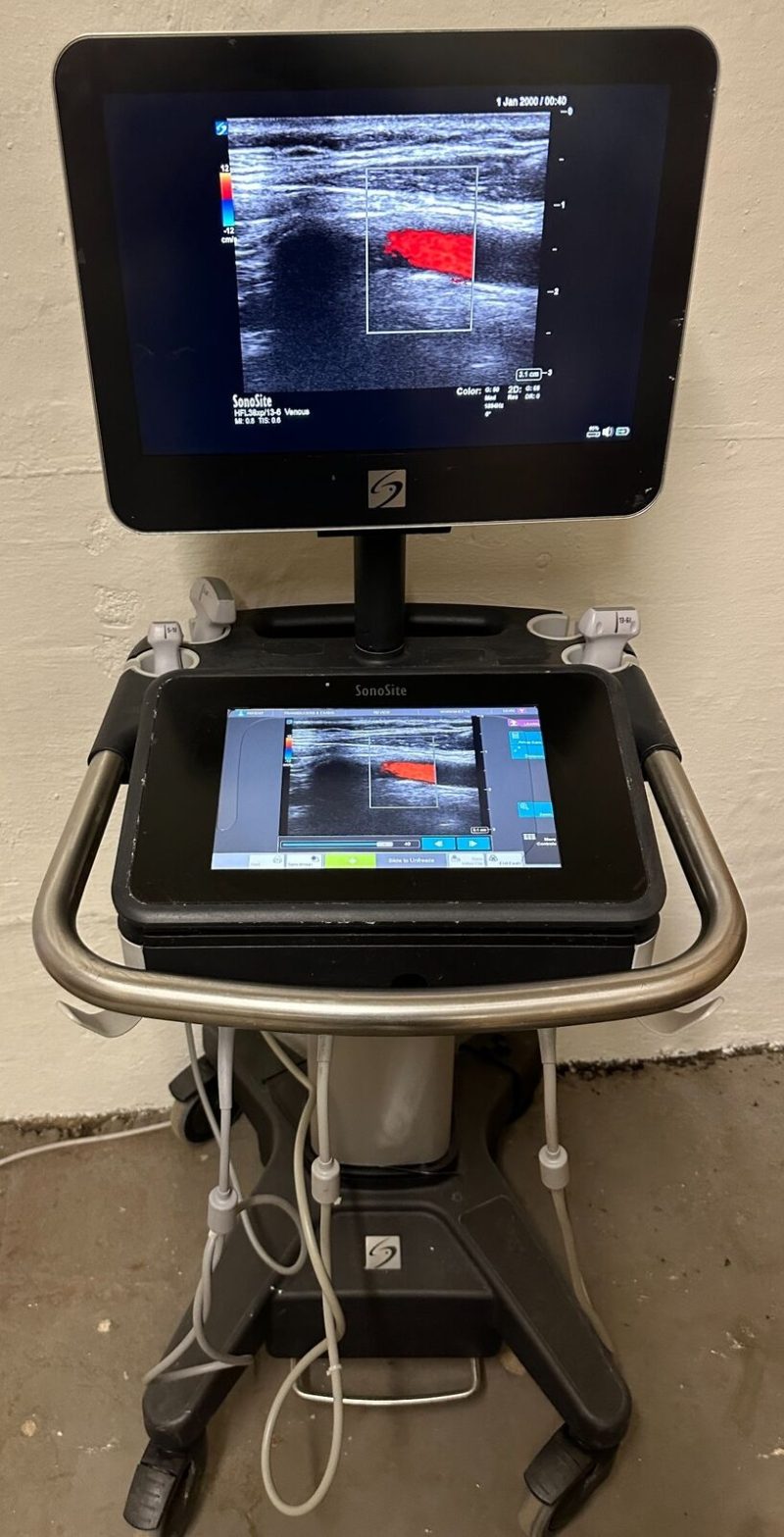 Sonosite X-Porte Ultrasound without probes manufactured 2021