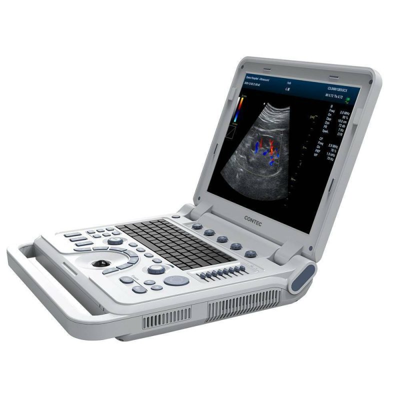 VET Veterinary Color Doppler Ultrasound Diagnostic Machine,rectal linear Probe