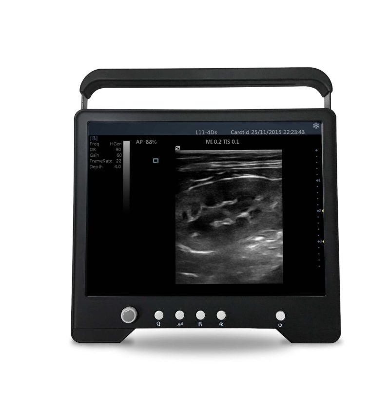 Veterinary TouchScreen Ultrasound&Micro-Convex Probe for Small Animals, KeeboMed